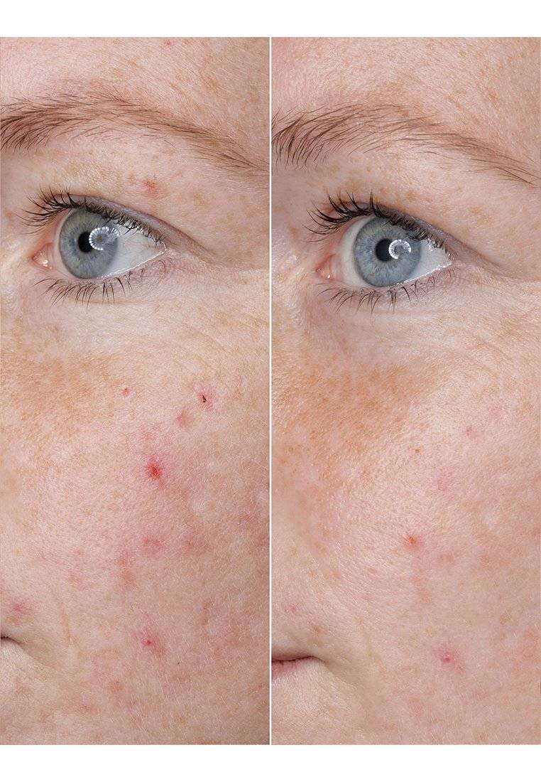 BABOR BABOR HYALURONIC ACID AMPOULE - Serum Top Angebot
